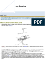 Nasopharyngeal Airway Insertion