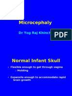 Microcephaly: DR Yog Raj Khinchi