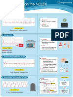 9 ECG Strips On The NCLEX