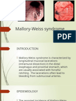 Mallory-Weiss Syndrome