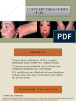 Systemic Lupus Erythematosus