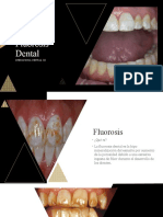 Fluorosis Dental