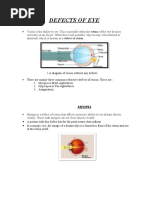 Defects of Eye