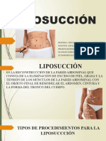 LIPOSUCCION