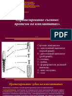 Протезирование съемных протезов на имплантатах