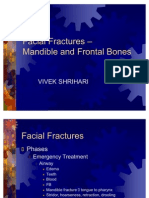 Facial Fractures Concise