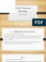 Abruptio Placenta