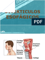 Copia de DIVERTICULOS ESOFÁGICOS