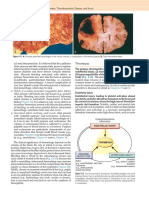 141 - PDFsam - Robbins & Cotran Pathologic Basis of Disease, 9e