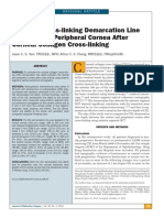 Reduced Cross-Linking Demarcation Line Depth at The Peripheral Cornea After Corneal Collagen Cross-Linking