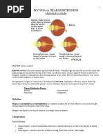 Myopia or Nearsightedness: A Refractive Error of The Eye