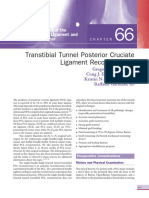 Transtibial Tunnel Posterior Cruciate Ligament Reconstruction