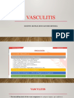 VASCULITIS