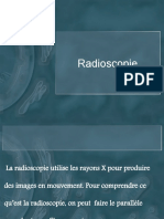 Radioscopie