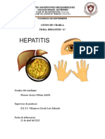 Hepatitis A