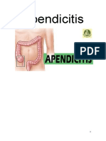 Apendicitis Murgia