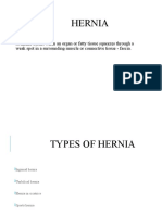 Hernia