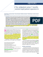 Bone Density of The Midpalatal Suture 7 Months After SARP in Adults