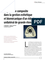 Article Prothèse Composite Stratégie Prothétique Montage