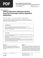 Villous Sebaceous Adenoma Arising From The Caruncular Surface Squamous Epithelium