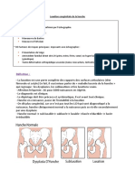 Luxation Congénitale de La Hanche Cours DR Ali Brahimi