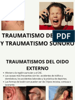 Traumatismo Sonoro Agudo