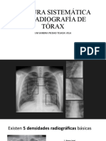 Lectura Sistemática de Radiografía de Tórax Im 2023