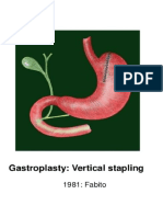 History of Bariatric Procedures Modifications