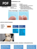 Indicaciones Lenticulares