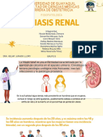 Litiasis Renal Exposición