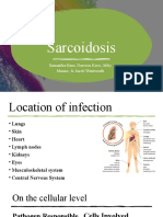 Sarcoidosis