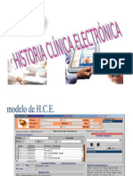 HCE