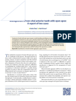 Management of Non Vital Anterior Teeth With Open Apex: A Report of Two Cases