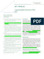 Management of Supracondylar Fractures of The Humerus in Children