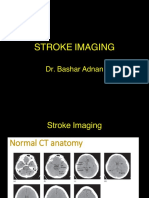 Stroke Imaging 1