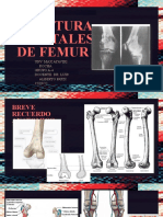 Fracturas Distales de Femur-1