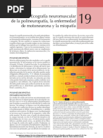 Ecografía Neuromuscular de La Polineuropatía, La Enfermedad de Motoneurona y La Miopatía