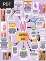 Mapa Mental Bocio y Nodulo Tiroideo