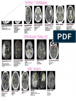 Neurología