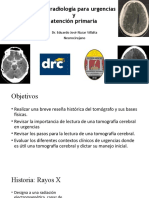 Tomografia Neuroimagen en Urgencias