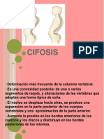 Cifosis