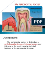 Periodontal Pocket