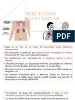 Tuberculosis Extrapulmonar