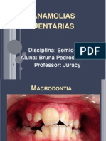 Anamolias Dentárias Bruna!