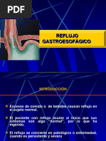 Reflujo Gastroesofagico