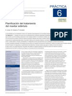 Treatment Planning of The Edentulous Maxilla