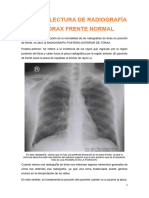 Lectura de Radiografía de Tórax Frente Normal