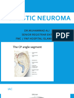 Acoustic Neuroma