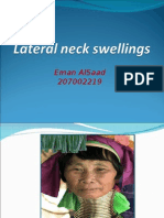 Lateral Neck Swelling