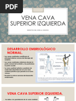 Vena Cava Superior Izquierda y Duplicacion de La Vena Cava Superior.